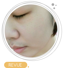 revue revue